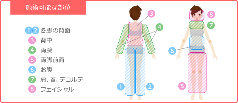 ハイパーナイフ・セルライトゼロ共通施術部位の図